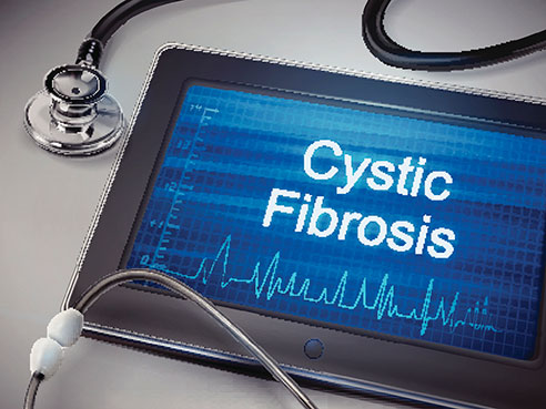 cystic fibrosis 2