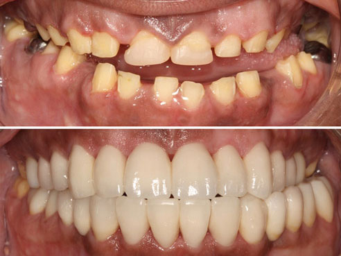 dentistry teeth