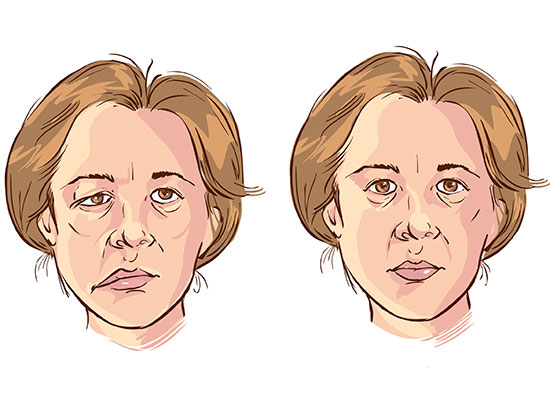 facial nerve clinic ts
