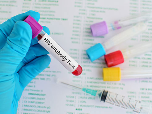 hiv antibody test