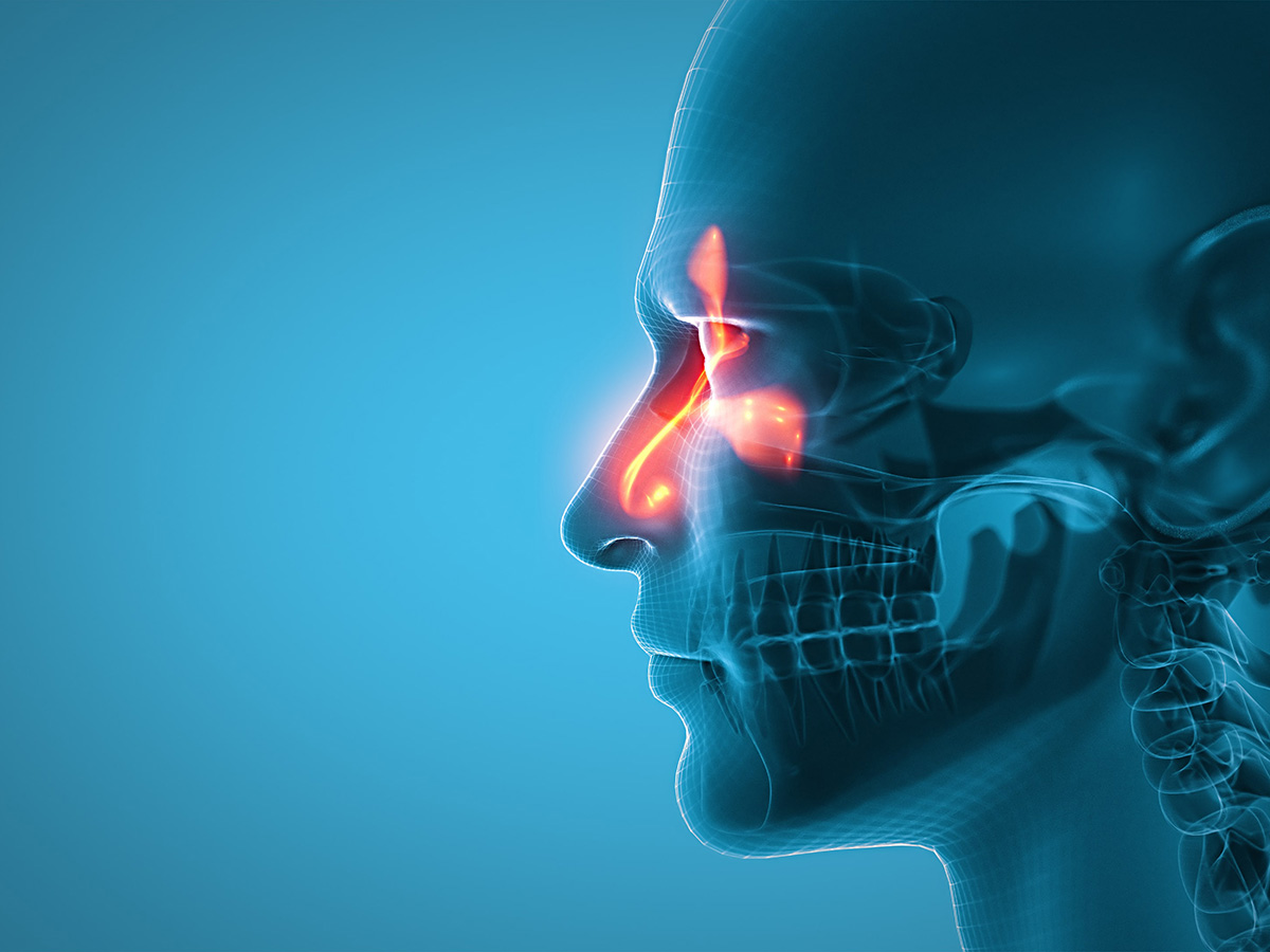 Emerging pathogen found to cause invasive fungal sinusitis in Southeastern United States