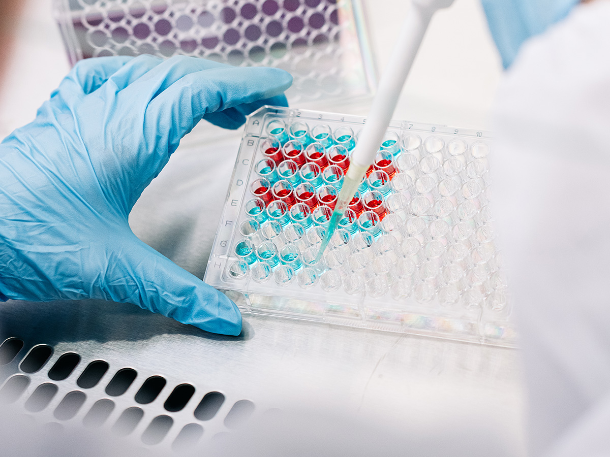 UAB researchers are developing safer psychedelic-inspired therapeutics to treat depression and addiction 