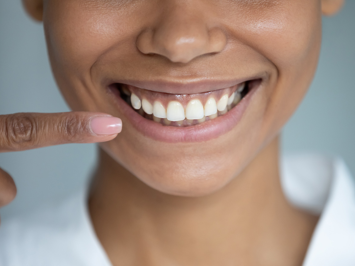 Lower half of young women's face as she smiles and points at her gums.