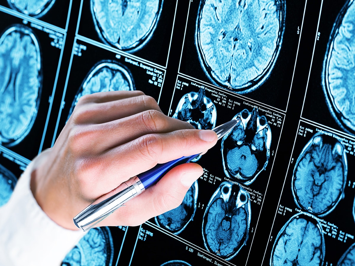Study shows brain training can reduce Alzheimer’s and dementia risk by 25 percent