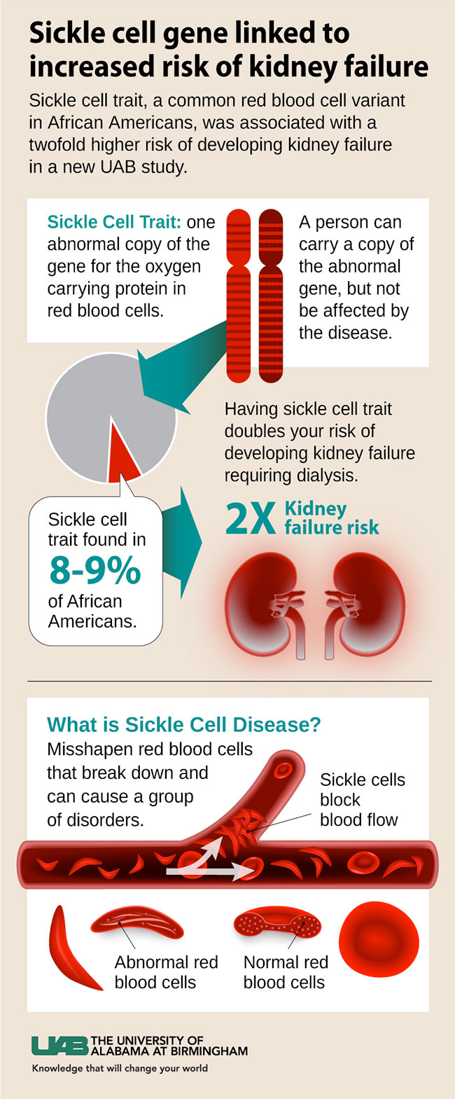 sickle cell graphic small
