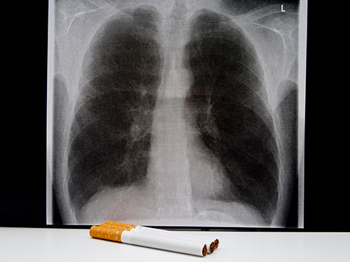 smoking COPD