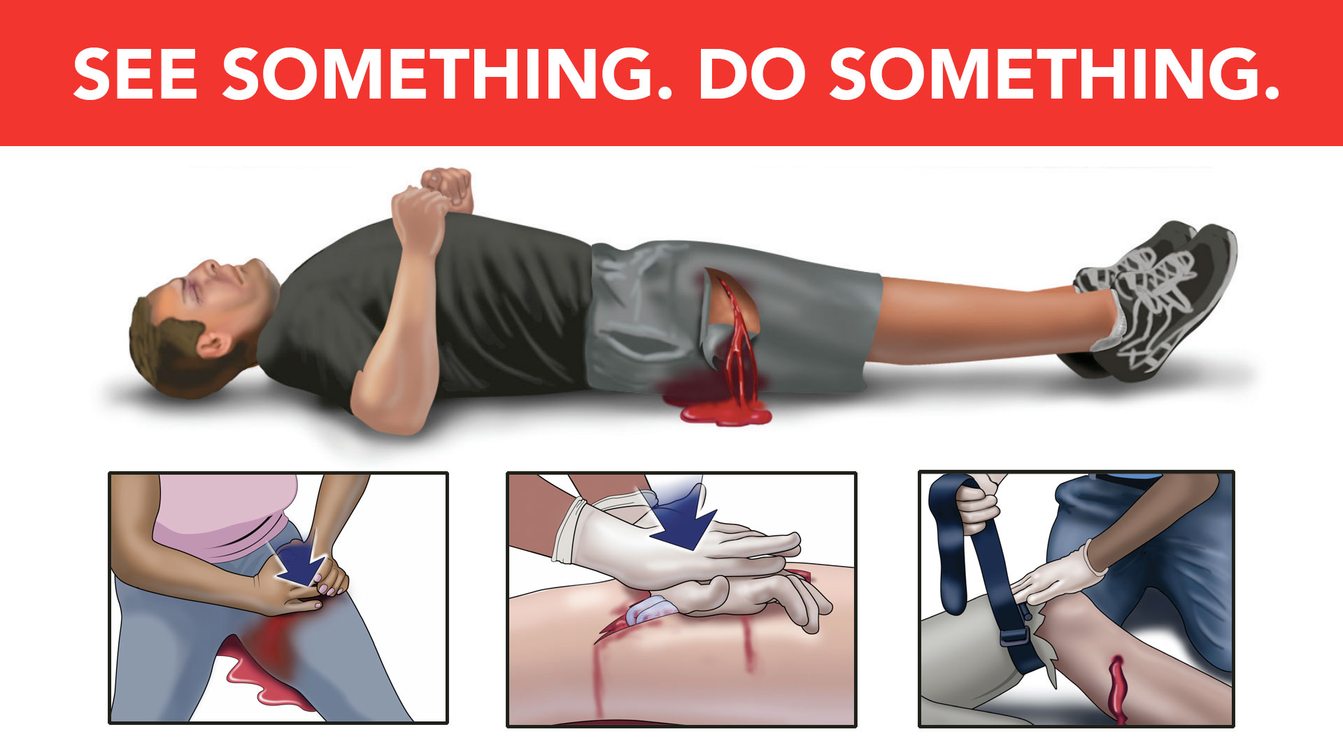 stop the bleed see something