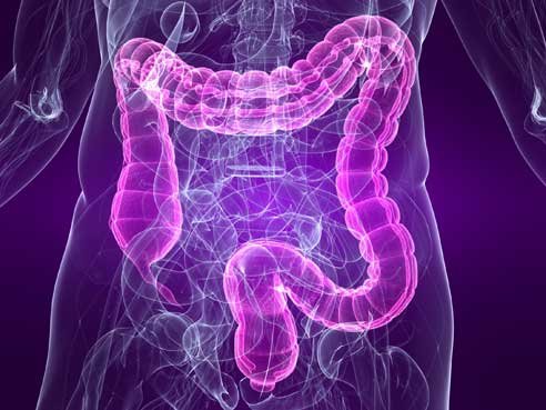 UAB study finds sigmoidoscopy reduces colorectal cancer rate