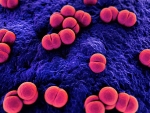 Cryptococcus is the true &quot;hidden epidemic,&quot; expert says