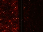 Study identifies chaperone protein implicated in Parkinson’s disease