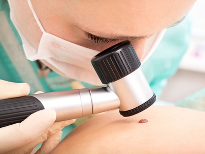 Novel procedure shortens stay for melanoma patients