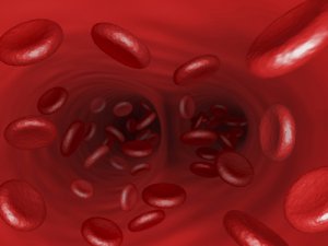 Study shows sickle cell anemia drug is safe, effective for infants and toddlers