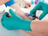 Biomarker test for rheumatoid arthritis proves effective in study