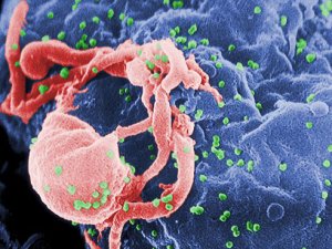 UAB on the front lines in 30-year war on HIV/AIDS