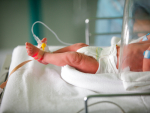 Around 40 percent of preterm infants with BPD-PH die before the age of 2. UAB studies establish two significant risk factors of the condition.