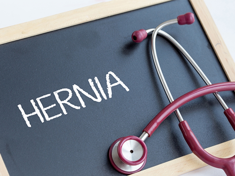 Learn about hernias, treatments and diagnoses