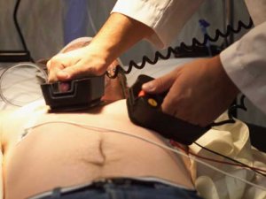 UAB researchers working to improve ‘dismal’ cardiac arrest rate