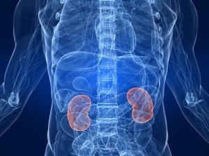 Ferritin plays central role in kidney damage by controlling iron