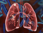 Potential therapeutic target found to combat tuberculosis, a disrupted NAD(H) homeostasis