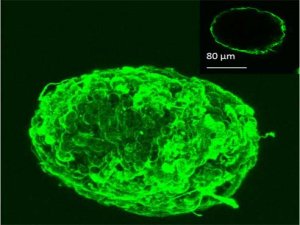New coating for pancreatic islets may offer new hope for diabetics