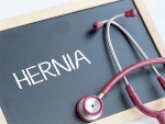 Hernias: why they hurt and what can be done