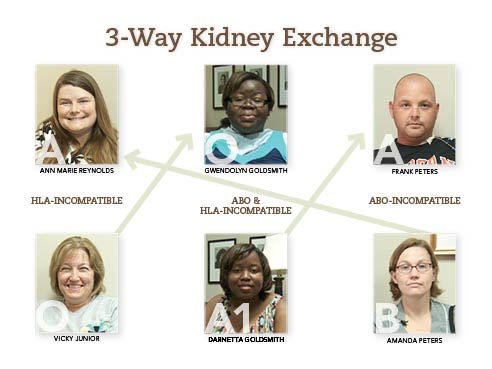 UAB launches paired exchange and incompatible kidney transplant program
