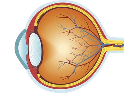 Changes in the eye might predict onset of frontotemporal dementia