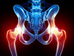 New techniques and understanding of hip disorders are leading to new ways to prevent or treat hip deterioration.