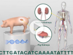 Xenotransplantation: what it is, why it matters and where it is going