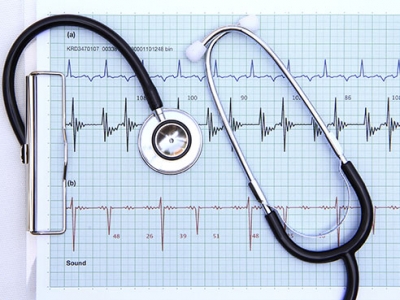 New REGARDS data show heart attack, stroke risk equations are accurate despite initial criticisms