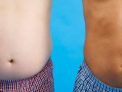 Oft-assumed reasons for racial obesity disparities may not be only cause, study says
