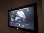 Grant expands telehealth, provides maternal-fetal medicine