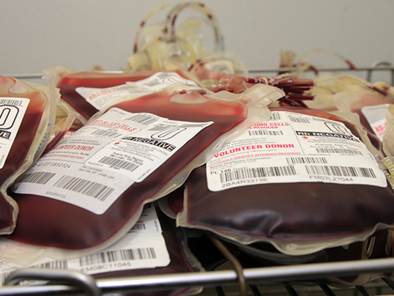 UAB Hospital using whole blood in transfusions for severe trauma