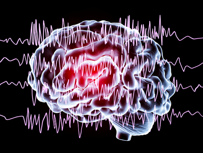 UAB-developed algorithm may predict the onset of seizure clusters