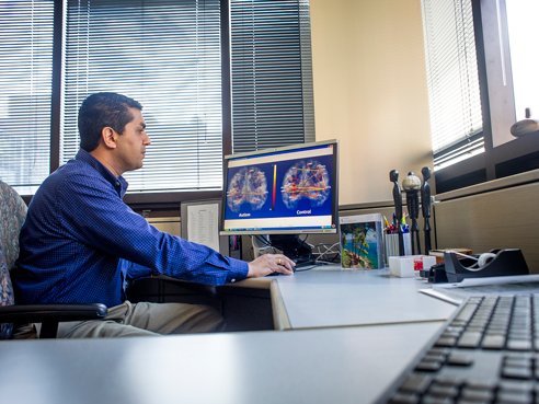 Research finds brain scans may aid in diagnosis of autism