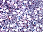 How ‘sleeper cell’ cancer stem cells are maintained in chronic myelogenous leukemia