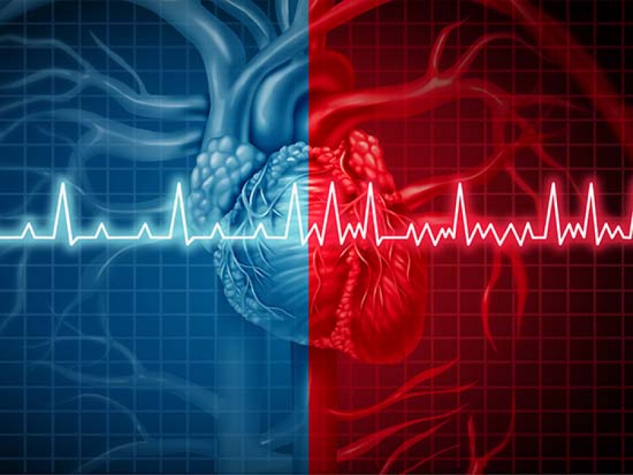 New research shows atrial fibrillation can be fatal even after strict ...