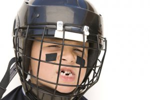 Sports dental injuries are no laughing matter