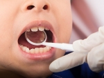 Research explores lasting effects of early preventive dental care in Medicaid-enrolled children