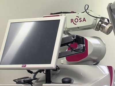UAB’s ROSA robot guides new epilepsy procedure