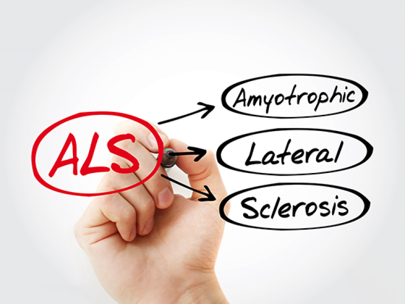 UAB’s new ALS clinic offers eight to one advantage