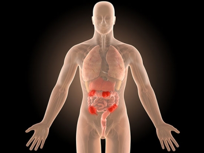 Immune cells that create and sustain chronic inflammatory bowel disease identified