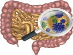 UAB study shows link between microbiome in the gut and Parkinson’s