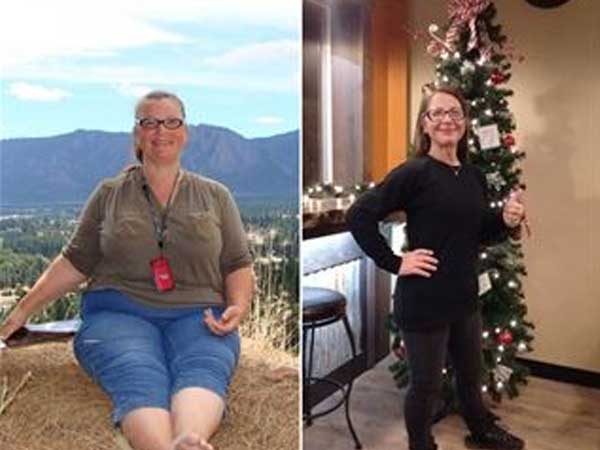 Before and after photo of Lorna Shelton, 58, who weighed nearly 250 pounds. She lost over 50 pounds in one year with time restricted feeding.