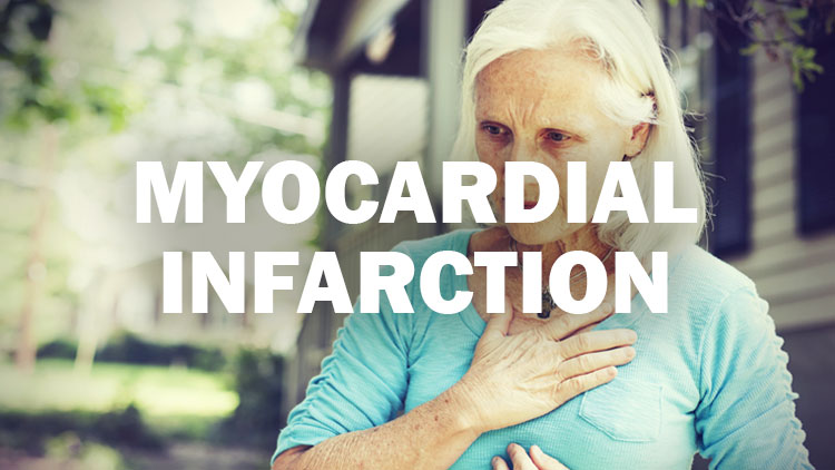 Recognizing Acute Myocardial Infarction in Women
