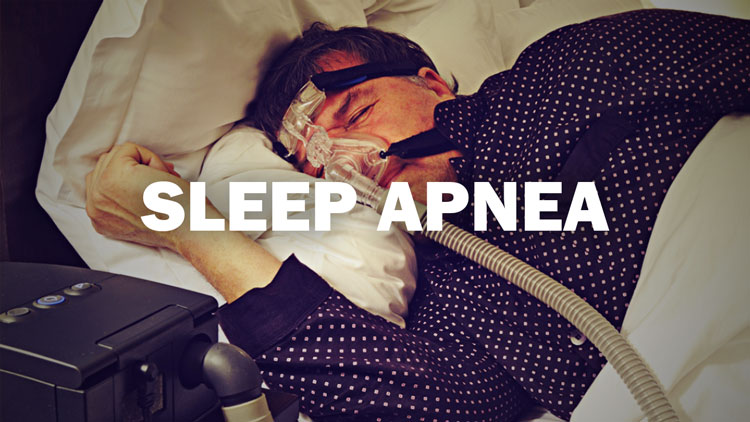 Waking Up to Obstructive Sleep Apnea