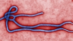 UAB School of Nursing offering Ebola course for health care providers