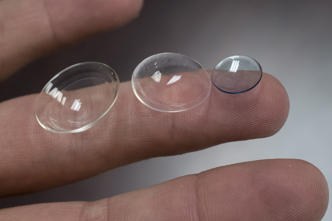 Scleral lenses help improve patient’s everyday life ...