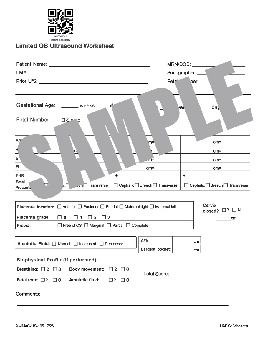 LIMITED OB US WORKSHEET