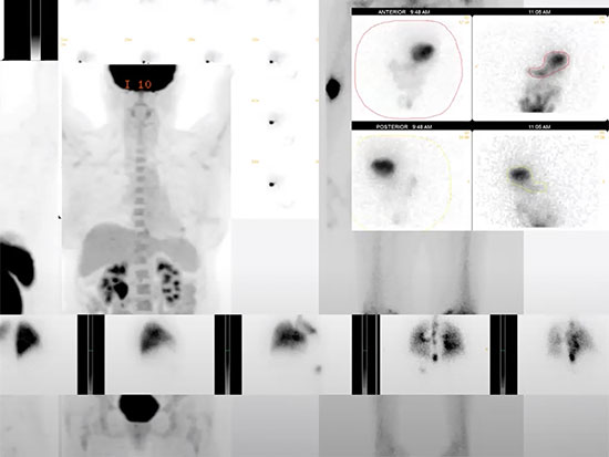 rep ai nuclear med screenshot 550px